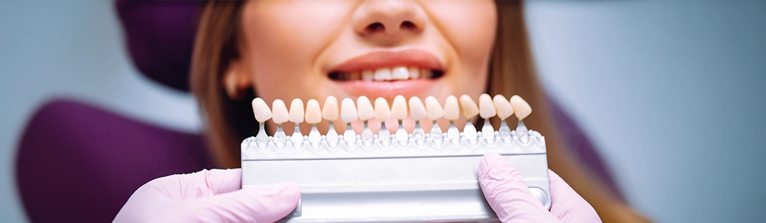 No-Prep Composite Veneers near Highland Park & Uptown | D’Aura Dallas